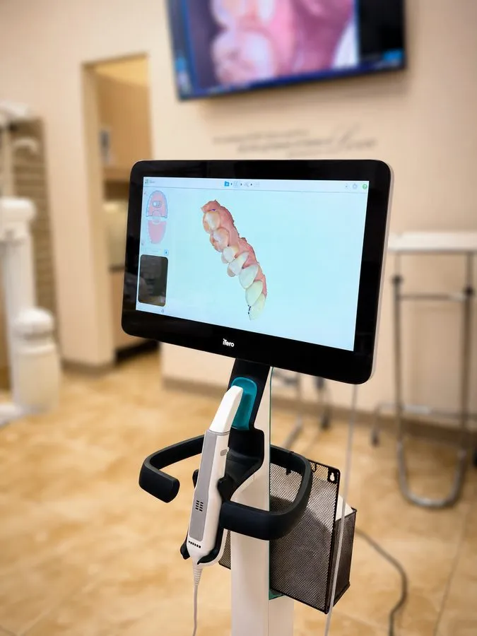 iTero digital intraoral scanner displaying a 3D dental impression at SoftDental Houston